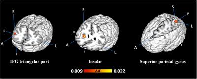 The Right Inferior Frontal Gyrus Plays an Important Role in Unconscious Information Processing: Activation Likelihood Estimation Analysis Based on Functional Magnetic Resonance Imaging